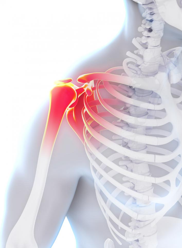 Lesões no manguito rotador podem ser reparadas através da artroscopia de ombro